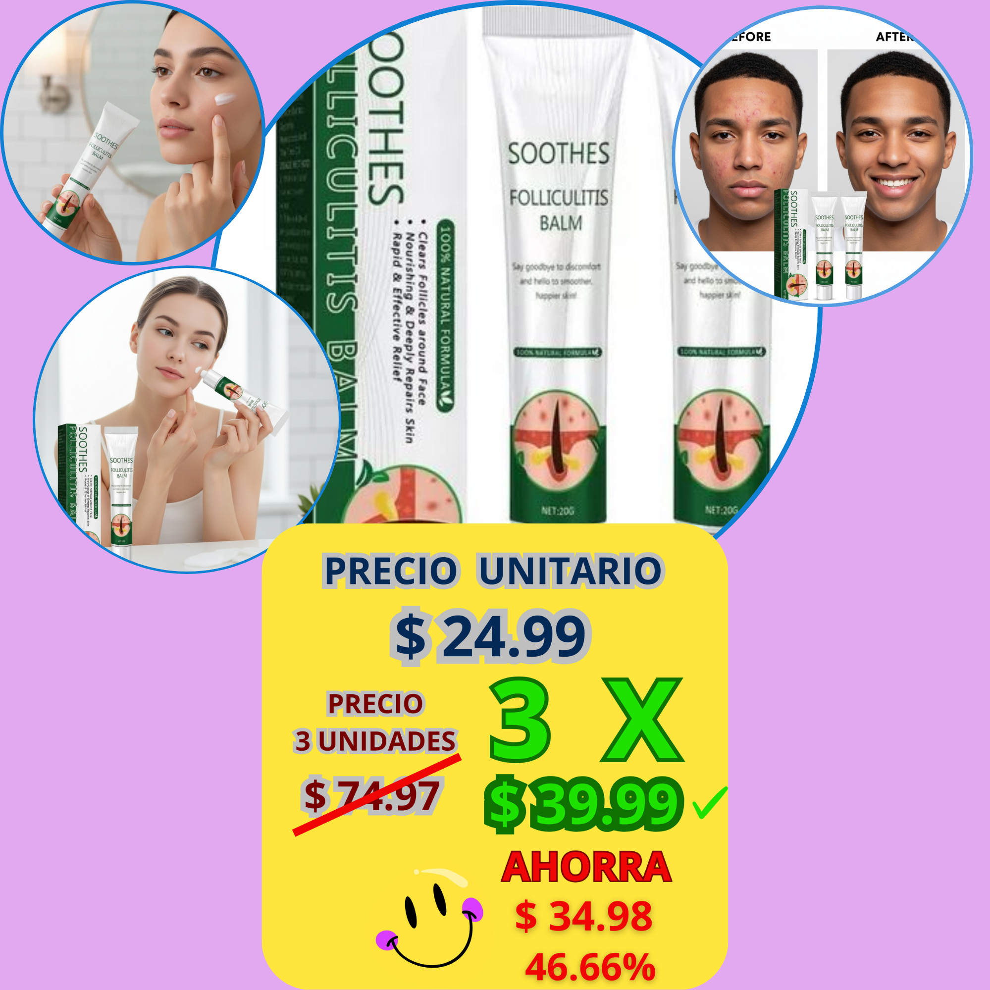 Crema Reparadora de Foliculitis