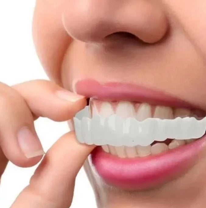 Carillas Dentales Cosmética Snapon Smile